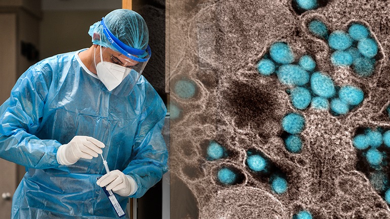 Καταμετρήθηκαν 306 νέα κρούσματα κορωνοϊού