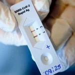 Αχαΐα: Πού θα γίνονται δωρεάν rapid test σήμερα 26 Μαΐου