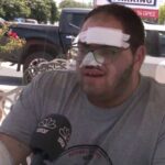 Κρήτη: «Με έβαλαν σε ψυγείο με κρέατα» – Συγκλονίζει ο μάγειρας που κάηκε με λάδι