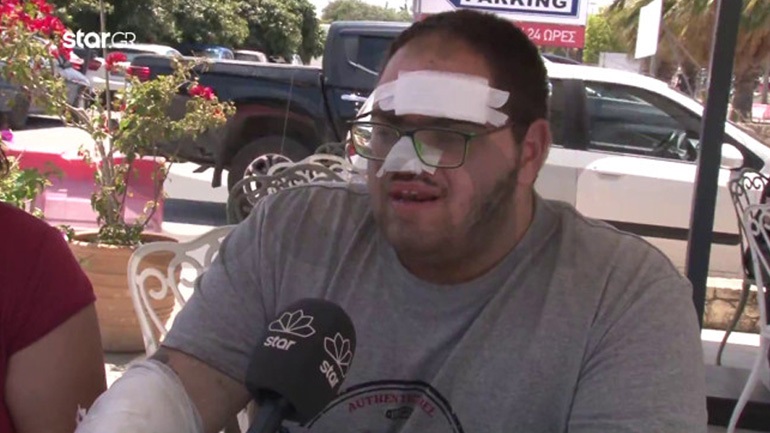 Κρήτη: «Με έβαλαν σε ψυγείο με κρέατα» – Συγκλονίζει ο μάγειρας που κάηκε με λάδι